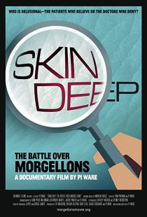 دانلود مستند Skin Deep: The Battle Over Morgellons 2019 ( پوست عمیق: نبرد بر سر مورگولون ها ۲۰۱۹ ) با لینک مستقیم